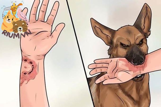 Những điều cần tránh và cách sơ cứu khi bị chó cắn